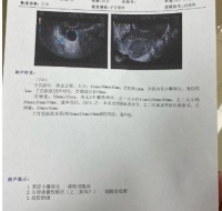 女性结婚后长时间不孕,可以尝试中医调理