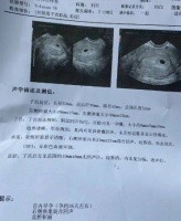 女性长久不孕怎么办?中医调理助孕是关键