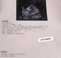 多囊不孕不要有太大压力，调整心态用中医调理效果显著