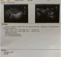 中医助孕高龄不孕女士患者