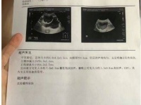 中医调理助孕，让不孕女性的好孕如期而至