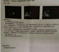 高金哲助理接待纪实005：流产后长时间不孕，中医调理来帮忙