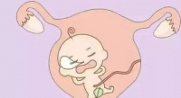 原创 子宫内膜薄会不孕吗 备孕妈妈们怎么应对