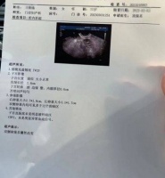 网上咨询，千里寄药，我的多囊卵巢在金哲堂国医馆看好了