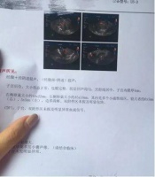 找中医调多囊卵巢,来回调了几个月,总算是调好了#金哲堂高金哲#