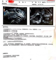 有没有跟我一样感触的姐妹,调理多囊卵巢还得看中医 #金哲堂高金哲#