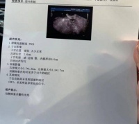 多囊卵巢怀孕难?那是你没找对方法,推荐金哲堂高金哲主任