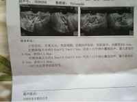 多囊卵巢、输卵管堵塞，没想到金哲堂高金哲主任三个月给调理怀孕了