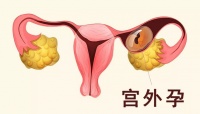 红睦房祝秀英医生:输卵管通而不畅,要不要治?
