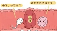 超声科知识点—4D子宫输卵管超声造影照亮好“孕”之路