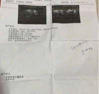 多囊卵巢还得看中医,金哲堂的高金哲就是一个中医圣手