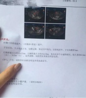 多囊卵巢怎么才能怀孕呢?治好才能怀孕#金哲堂国医馆#