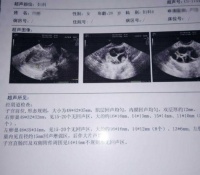 现在看病真方便,视频面诊就能搞定多囊卵巢#金哲堂#