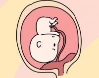 子宫内膜息肉是什么?能直接做试管婴儿吗?