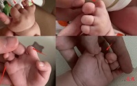 宜春妇保被质疑漏诊!试管婴儿7个手指畸形 20多次产检未发现