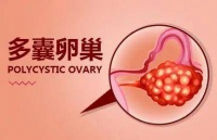 别被无所谓耽误了治疗！多囊卵巢综合征「备孕、孕后」需要这样治！