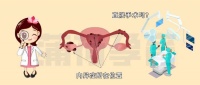 内异症,直接试管促排还是先做手术?
