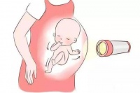 子宫内膜异位导致怀不上,可以做试管婴儿吗?