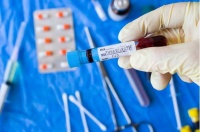 女性HIV能做三代试管吗?要注意什么?