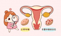 南京不孕不育:多囊女性如何备孕?7大措施助你怀孕率飙升