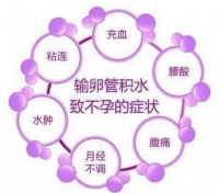 希恩宝贝:卵管不通、积水影响女性正常生育?哈萨克斯坦辅助生殖专家为您揭晓