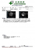 高龄+巧囊,一次试管喜迎好“孕”
