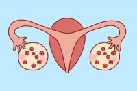 禾孕嘉丨女性促排后不取卵的潜在风险:从感染到腹水的全面审视