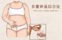 4个备孕期间很重要的环节,很多人忽视,关注起来助你备孕科学排毒