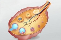 禾孕嘉丨卵泡萎缩的多重原因解析:不仅仅是发育不良