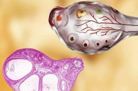 禾孕嘉丨AMH值低但基础卵泡多的奥秘:探究背后的原因