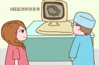 助你好“孕”——超声卵泡监测