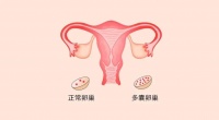 多囊备孕迟迟怀不上,怎么办?