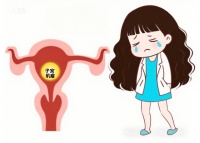 备孕遇上子宫肌瘤，一定要手术吗？