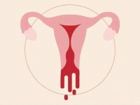 BBT技术为哪般？精准守护子宫，为生育希望留一盏灯丨西安邱学华妇科