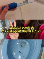 痔疮肉球真的摸不到啦！可以安心备孕了！