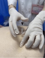 【中医助孕】备孕先减肥？中医帮你养出易孕体质