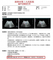 受精卵跑哪去了？女子怀孕照B超找不到“宝宝”！一查惊了…