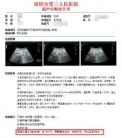 受精卵跑哪去了？女子怀孕照B超却怎么也找不到“宝宝”！一查惊了