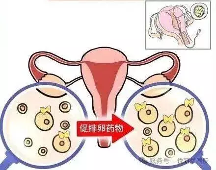 短时间多次取卵，卵子质量会不会打折？