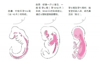 二维、三维、四维超声检查有什么不同