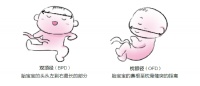 孕妈妈们做B超时要注意什么?