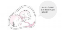 胎宝宝脐带绕颈应该怎么办?
